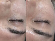 ビーマジック(Be Magic)/メンズ眉毛＆毛穴洗浄