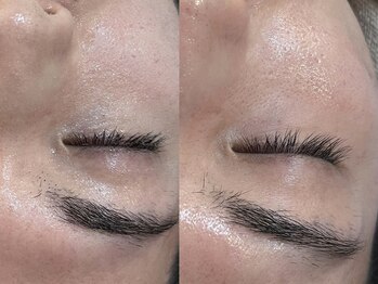 ビーマジック(Be Magic)/メンズ眉毛&毛穴洗浄