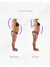 ココ ビューティ(COCO Beauty)/痩身ビフォーアフター
