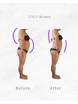 ココ ビューティ(COCO Beauty)/痩身ビフォーアフター