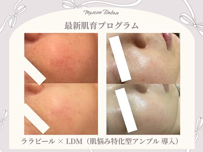 メゾンリュバン 梅田店(Maison Ruban)の写真