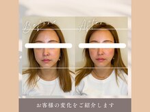 整え屋 レッド(RED)/30代女性　小顔矯正・全身整体