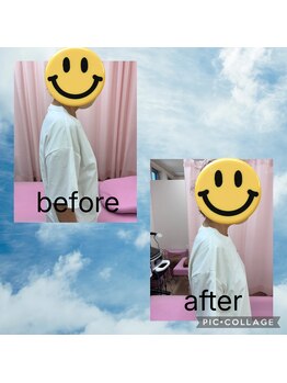 さくら接骨院/施術のbefore after