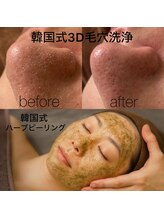 ミシェル(MICHELL)