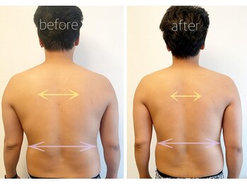 パル コルギサロン(Pal. Korugi salon)/メンズビフォーアフター