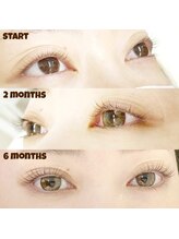 くるるん/◆ラッシュアディクト◆