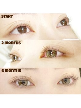 くるるん/◆ラッシュアディクト◆