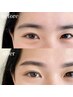 【学割】眉毛Waxスタイリング×プラズマでツルすべ肌に♪7000円