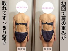 モモナ(Momona)/#肩こり#リンパマッサージ#野並