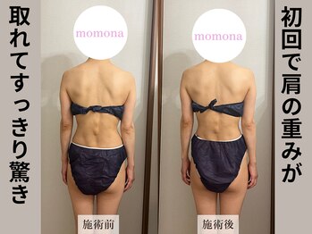 モモナ(Momona)/#肩こり#リンパマッサージ#野並