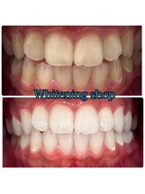 ホワイトニングショップ 北千住店/北千住ホワイトニング