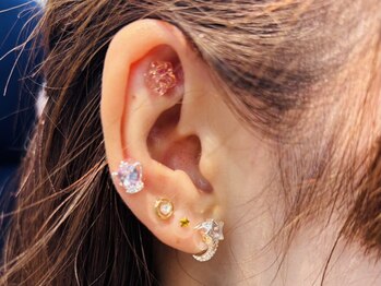 ラブリエ(la briller)の写真/【結果重視の方必見】《耳つぼ施術+食事指導+カウンセリング》で理想の”美Body”を手に入れる☆