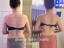 グラツィア 銀座(Grazia)/8回【 ブライダルエステ整体 】