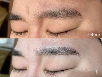 エピア 西尾店(Epia)/【眉毛脱毛】※途中経過