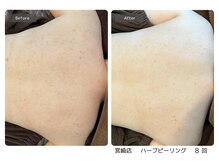 エミルカ 宮崎店(EMILUCA)/気になる背中のケアもお任せあれ