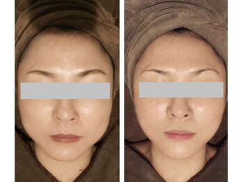 サロンリーナ 銀座店(SalonLena)/自分最強小顔!