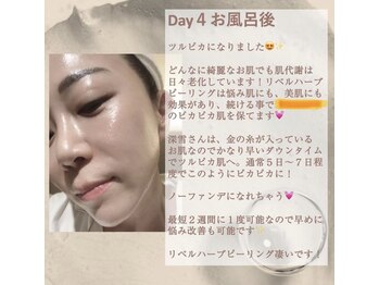 ノーブル 新宿南口(NOBLE)/ダウンタイムの様子