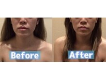 アジール 長岡リバーサイド千秋店(agir)/before/after画像