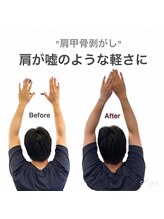 アサバ整体院 江戸川台店(ASABA整体院)/肩甲骨剥がしの結果写真