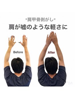 アサバ整体院 江戸川台店(ASABA整体院)/肩甲骨剥がしの結果写真