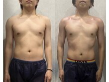 アーネスト(EARNEST)/【比較写真】メンズ痩身！