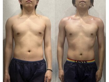 アーネスト(EARNEST)/【比較写真】メンズ痩身!