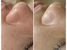 メイン(main)/★before after★