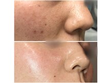 ディンプル(Dimple)の雰囲気（お悩みに合った改善ルートをご案内します。ニキビ　フェイシャル）