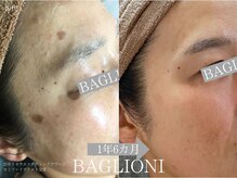 メディカルサロン バリオーニ/2025年肌改善セミファイナリスト