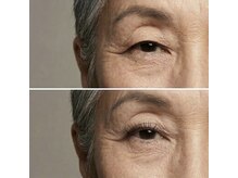 ミニョン 千葉(Mignon.)/まつげパーマ［千葉/千葉駅］