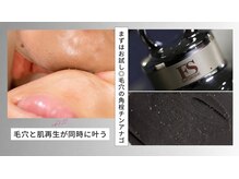 ゼニス 池袋本店(ZENITH)の雰囲気（最新の韓国毛穴洗浄で、角栓ケアと小顔効果を同時にGET♪）