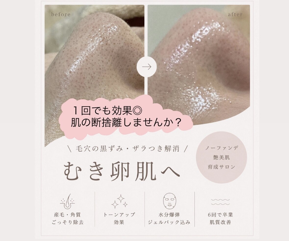 ルビーセル 大阪｜ホットペッパービューティー