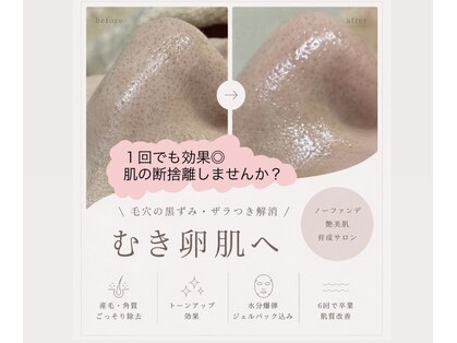 ルビーセル 大阪の写真