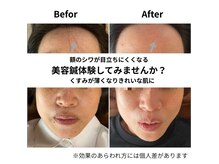 つむぎ養生堂マッサージ処の雰囲気（美容鍼を継続することで変化を実感。効果には個人差があります）