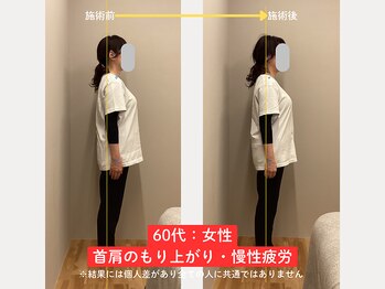 ソルム(solmu)/