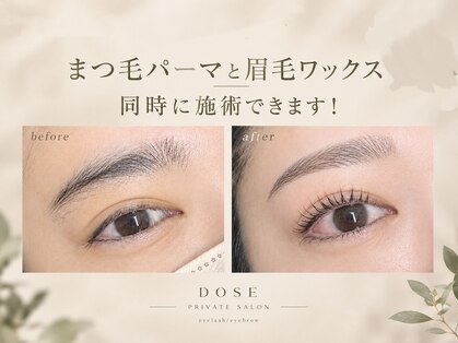 ドース(DOSE)の写真