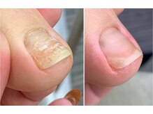 アートラウンジリハナ(Art Lounge Rihana)/フットケア