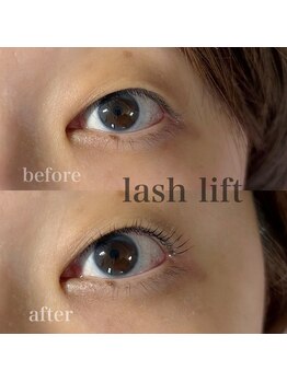 エミナル(EMINAL)/ラッシュリフト