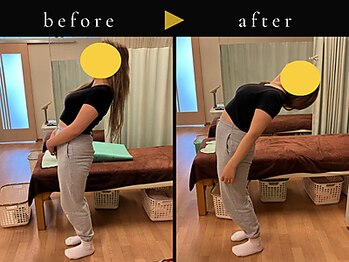 杉本接骨鍼灸院/背骨から全身がユルユル整体