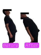 鍼の魔法 恵比寿院/腰の痛み　施術回数:1回