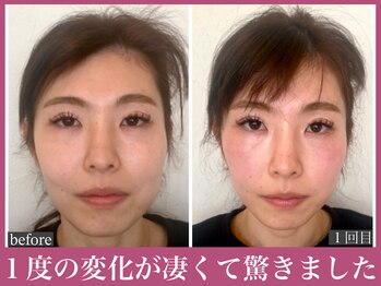 アクアビー(AQUA-B)/