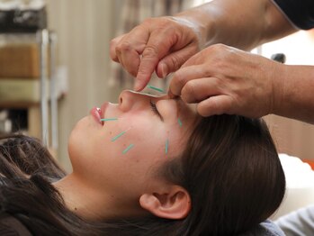 ながたともひさ指圧はり灸治療院の写真/【肩こり/腰痛/足の疲労に◎1回3000円】溜まった疲労を根本改善！急性的な痛みには鍼施術がおすすめ☆