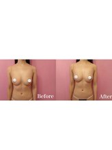 ドリームバスト 南森町(Dream Bust)/3ヶ月で理想の姿へ/バストアップ