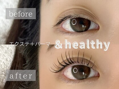 アンビーユー(ANBE.U)の写真