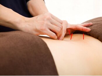 テンジン鍼灸整骨院(Tin-Jin鍼灸整骨院)の写真/めまい・肩こり・眼精疲労・冷え性・不眠・『慢性疲労・しびれ・不調』の時は『鍼灸を受けに行こう！』