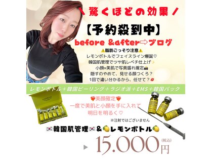 エクシア(Excia)の写真