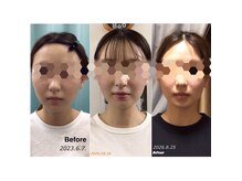 サロン ナウ オア ネバー(Salon Now or Never)の雰囲気（男女問わず、小顔、猫背改善もおまかせ下さい！）
