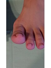 フットケアサロン ラビフット(Rabbi foot)/爪が乾燥すると巻爪になりやすい