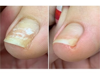 アートラウンジリハナ(Art Lounge Rihana)/フットケア