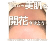 肌は替えがない一生もの！さぁ眠っていた美肌が開花する時を